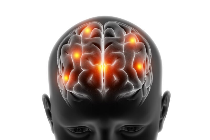 3D render of a medical figure with brain highlighted on white background